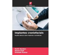 Implantes craniofaciais: Noções básicas sobre implantes craniofaciais