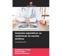 Implantes zigomáticos na reabilitação de maxilas atróficas: Uma análise exaustiva