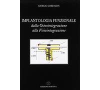 Implantologia funzionale dalla osteointegrazione alla fisiointegrazione
