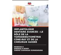 IMPLANTOLOGIE DENTAIRE AVANCÉE : LE RÔLE DE LA TOMODENSITOMÉTRIE CONE-RAY ET DE LA CHIRURGIE GUIDÉE