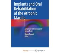 Implants and Oral Rehabilitation of the Atrophic Maxilla: Advanced Techniques and Technologies