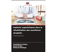 Implants zygomatiques dans la réhabilitation des maxillaires atrophiés: Un examen approfondi