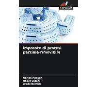 Impronte di protesi parziale rimovibile