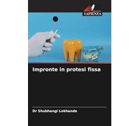 Impronte in protesi fissa