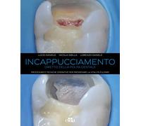 Incappucciamento diretto della polpa dentale. Procedure e tecniche operative per preservare la vitalità pulpare. Con QR code