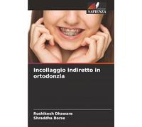 Incollaggio indiretto in ortodonzia