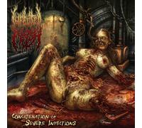 Infected Flesh - Concatenation of Severe Infections