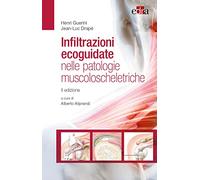 Infiltrazioni ecoguidate nelle patologie muscoloscheletriche