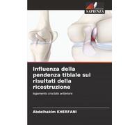 Influenza della pendenza tibiale sui risultati della ricostruzione: legamento crociato anteriore