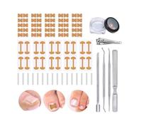 Ingrown Toenail Corrector Set with Correction Strips & Toenail Lifter & File,Professional Pedicure Tools Kit for Ingrown or Curved Toenails,Curved Toenails Corrector Patch (1 set)