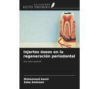 Injertos óseos en la regeneración periodontal: Una visión general