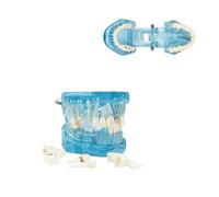 Insegnamento Dentale Stampo Modello di Anatomia Dentale Modello Trasparente Modello Dentale Denti Denti Modello Dentale Trasparente Modello Dentale Dentista Standard malattia patologia Rimovibile