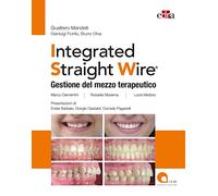 Integrated straight wire. Gestione del mezzo terapeutico