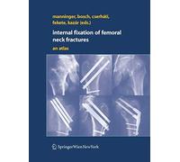 Internal Fixation of Femoral Neck Fractures: An Atlas