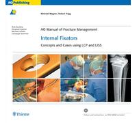 Internal Fixators: Concepts and Cases Using Lcp and Liss