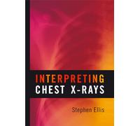 Interpreting Chest X-rays