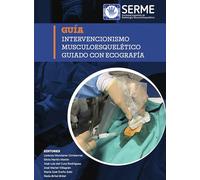Intervencionismo musculoesquelético guiado con ecografía