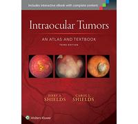 Intraocular Tumors: An Atlas and Text