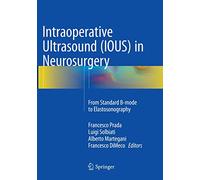 Intraoperative Ultrasound (IOUS) in Neurosurgery: From Standard B-mode to Elastosonography
