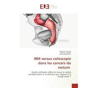 IRM versus coloscopie dans les cancers du rectum: Quelle méthode reflète le mieux la réalité peropératoire et la distance par rapport à la marge anale ?