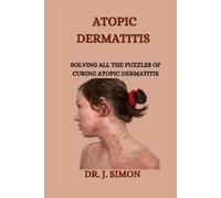 J Simon Atopic Dermatitis (Tascabile)