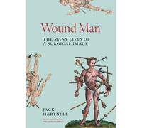 Wound Man: The Many Lives of a Surgical Image