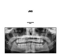 Jack Van Cleaf JVC (CD) Album