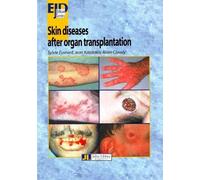 Jean Kanitakis Alain Claudy Sylvie Skin Diseases After Organ Transpl (Tascabile)