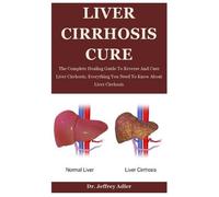 Jeffrey Adler Dr. Jeffrey Adler Liver Cirrhosis Cure (Tascabile)
