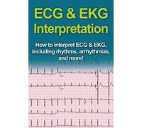 Jeremy Pine ECG & EKG Interpretation (Tascabile)