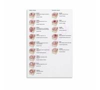JMVLVLOA Skin Conditions and Anatomy Chart Reference for Healthcare Training(Framed,12x18inch(30x45cm))