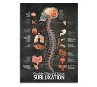 JMVLVLOA Spinal Subluxation Poster for Chiropractic Clinic Office Decor | Helps patients visualize why spinal adjustments improve wellness naturally(Unframed,08x12inch(20x30cm))