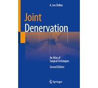 Joint Denervation: An Atlas of Surgical Techniques
