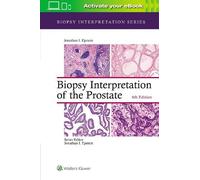 Jonathan I. Epstein Biopsy Interpretation of the Prostate (Copertina rigida)