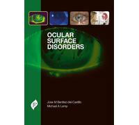 Jose M Benitez-del-Castillo Michael A L Ocular Surface Disord (Copertina rigida)