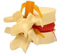 Joskeijky Modello di vertebre lombari colonna vertebrale anatomica ernia disco lombare strumento di insegnamento anatomia modello di vertebre lombari