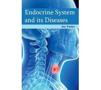 Joy Foster Endocrine System and Its Diseases (Copertina rigida)