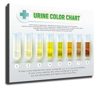 JRBJWYVV Urine Color Health Chart Hydration Reference Poster for Doctor Office Patient Education(Unframed,08x12inch(20x30cm))