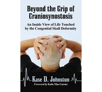 Kase D. Johnstun Beyond the Grip of Craniosynostosis (Tascabile)