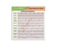 KCDFDVJFBM 12 Lead ECG Quick Reference Poster Heart Rhythm Interpretation Guide Canvas Print Clinical Knowledge Wall-Art for Study Room Clinic(Framed,16x24inch(40x60cm))