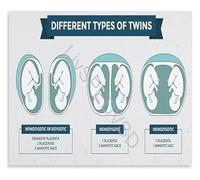 KCDFDVJFBM Detailed Placentation of Twins Chart Obstetric Anatomy Poster Educational Wall-Art Canvas for Home Study Decor(Unframed,16x24inch(40x60cm))