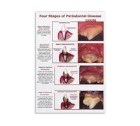 KCDFDVJFBM Dog Periodontal Disease Poster Canine Four Stages Guide Gingivitis to Tooth Loss Chart Wall-Art for Pet Care Clinic Office Decor(Framed,08x12inch(20x30cm))
