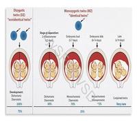 KCDFDVJFBM Educational Wall-Art Placentation of Twins Anatomical Chart Poster Canvas for Future Parents Nursery Decor(Unframed,16x24inch(40x60cm))