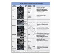 KCDFDVJFBM OB Ultrasound Terminology Guide Poster First Trimester and Early Pregnancy Terms Reference(Framed,08x12inch(20x30cm))