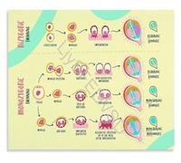 KCDFDVJFBM Obstetrics Placentation of Twins Chart Informative Poster Educational Wall-Art Canvas Print for Hospital Office Decor(Unframed,12x18inch(30x45cm))