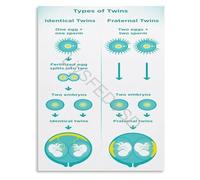 KCDFDVJFBM Twin Pregnancy Development Placentation Chart Poster Educational Wall-Art Canvas for Hospital and Nursery Decor(Unframed,12x18inch(30x45cm))