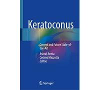 Keratoconus: Current and Future State-of-the-art