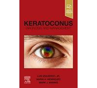 Keratoconus: Diagnosis and Management