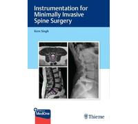 Kern Singh Instrumentation for Minimally Invasive Spine Su (Mixed Media Product)