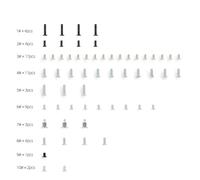 KEXIAO Set di viti complete da 58 pezzi per riparazione console di gioco Lite Set di viti a testa di ricambio